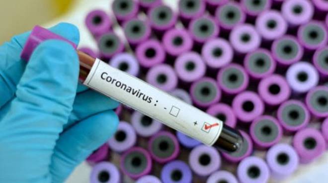 Coronavirus test